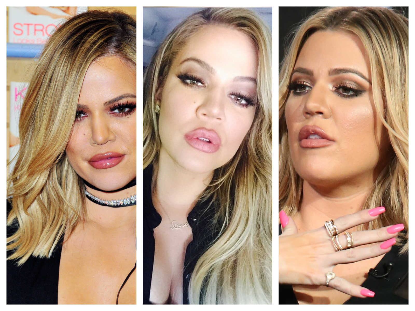 Khloé Kardashian critiquée pour ses &quot;duck lips&quot;