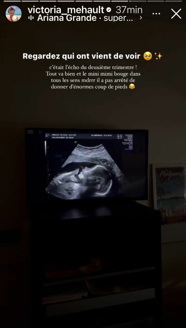 Victoria Mehault bientôt maman : la première photo de son futur bébé dévoilée