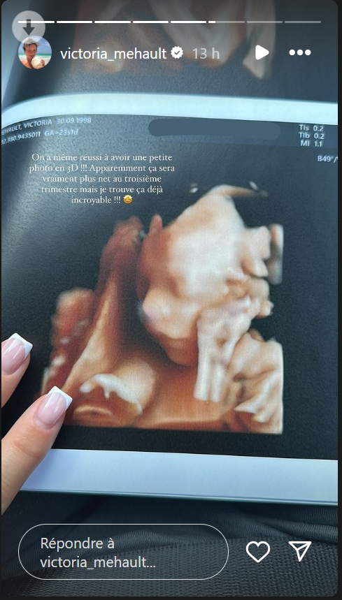 Victoria Mehault bientôt maman : la première photo de son futur bébé dévoilée