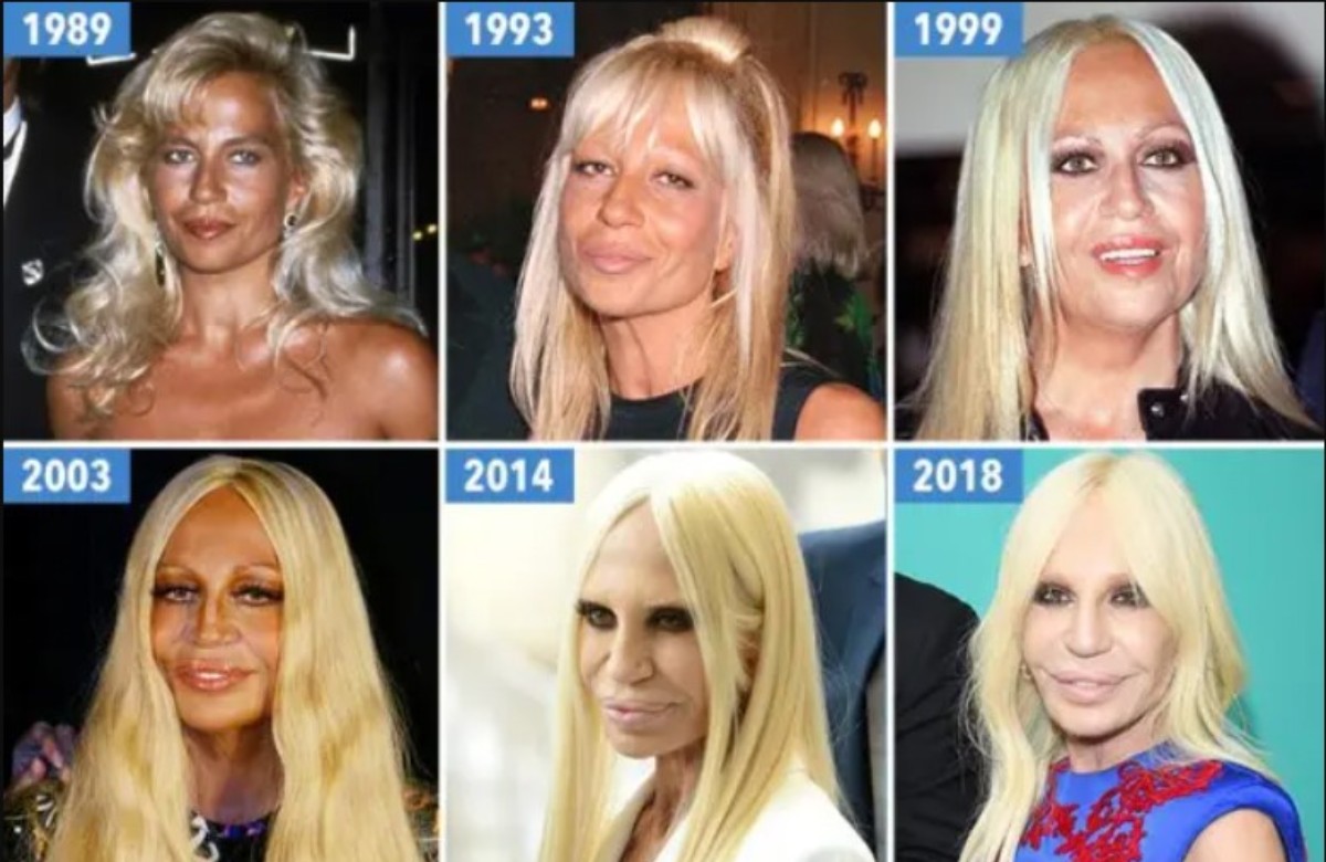 Le nouveau visage de Donatella Versace choque les internautes, mais...