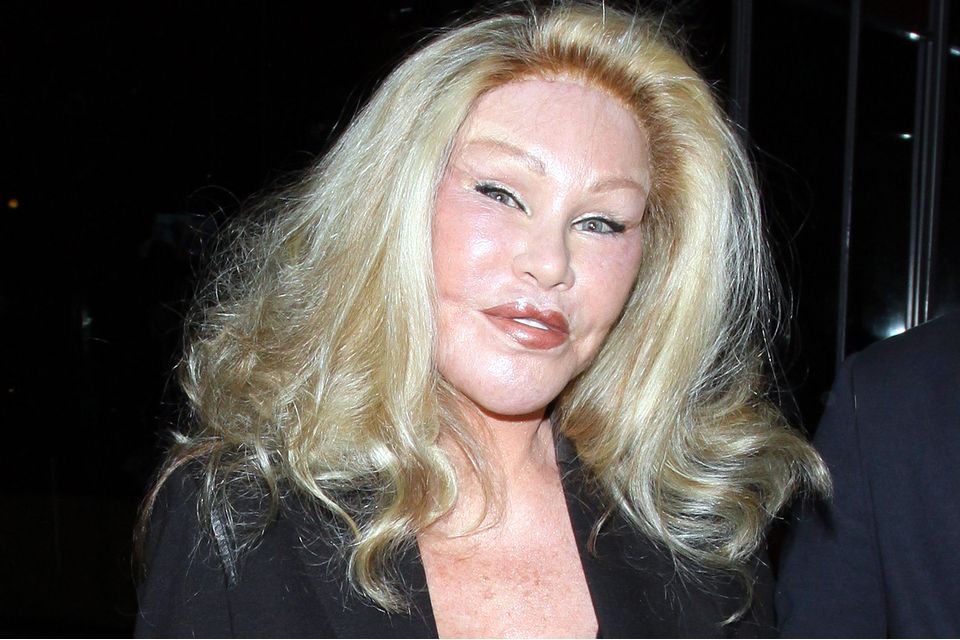 Jocelyn Wildenstein : &quot;la femme-chat&quot; est décédée... Les causes de sa mort dévoilées